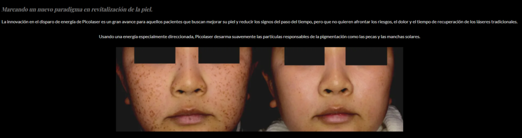 Eliminación de pecas